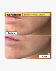 Dr.Jart Ceramidin™ Ectoin® Infused Cream