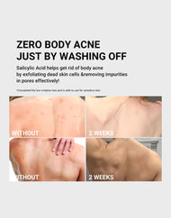 Medicube Red Acne Body Wash