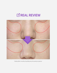Sungboon Editor Meoru Podo Vita C Turn-Over Dark Spot Pad